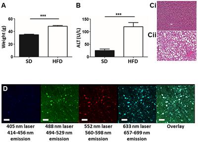 Optimization of In vivo Imaging Provides a First Look at Mouse Model of Non-Alcoholic Fatty Liver Disease (NAFLD) Using Intravital Microscopy